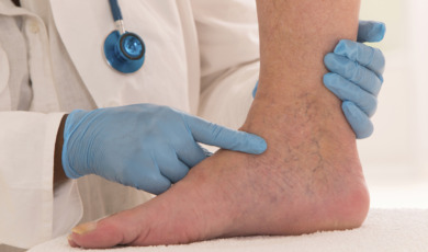 Lower limb vascular examination