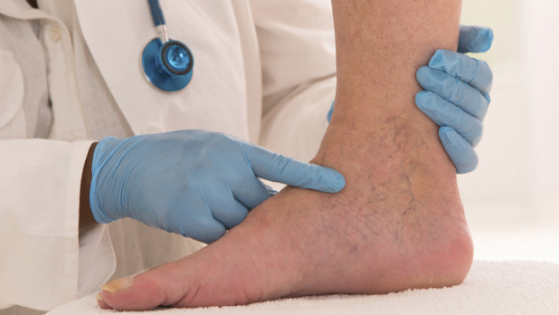 Lower limb vascular examination