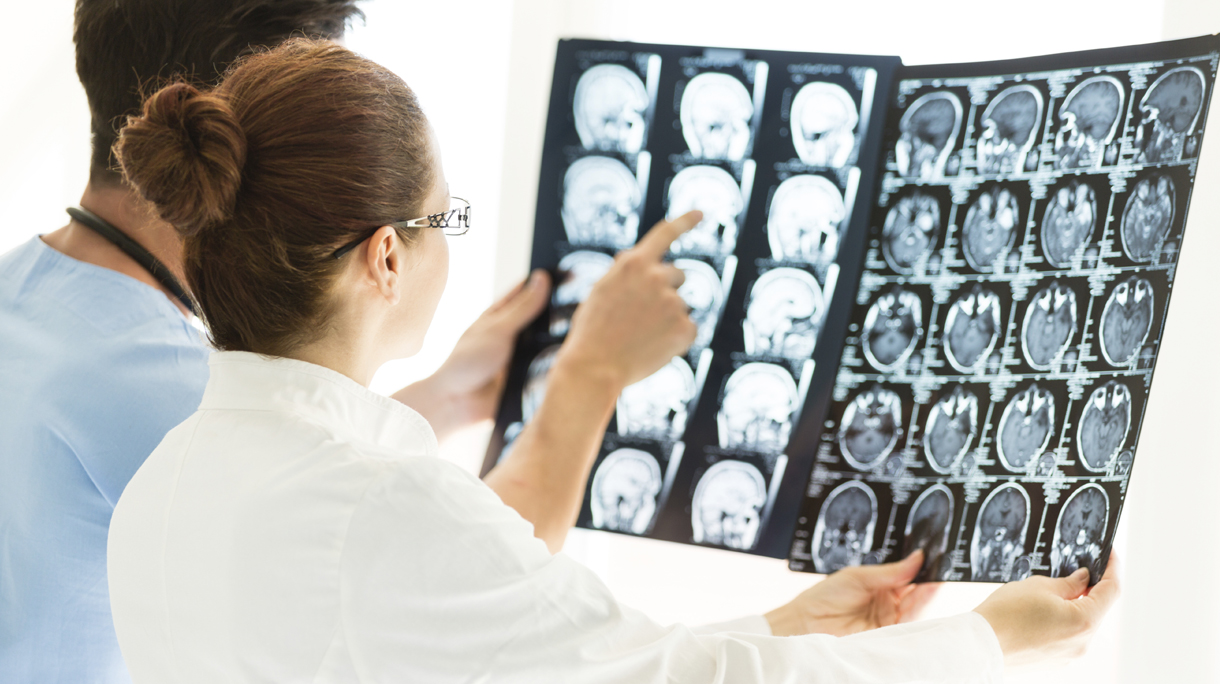 Doctors Looking At MRI Scan Of The Brain