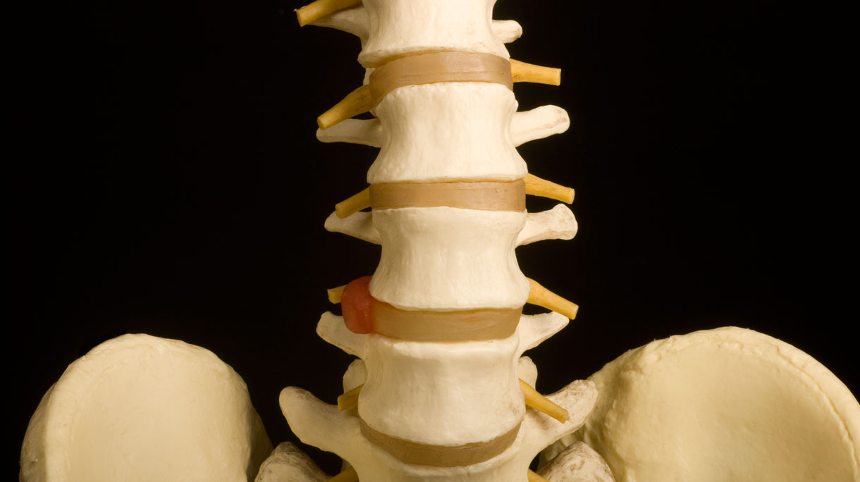 istock_7676696_large