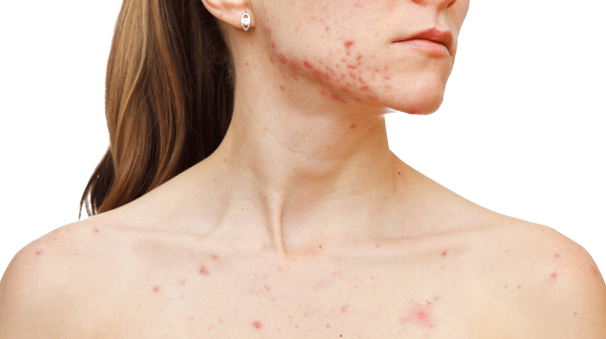 istock-657492188