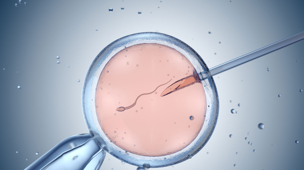 In vitro fertilisatie (IVF)