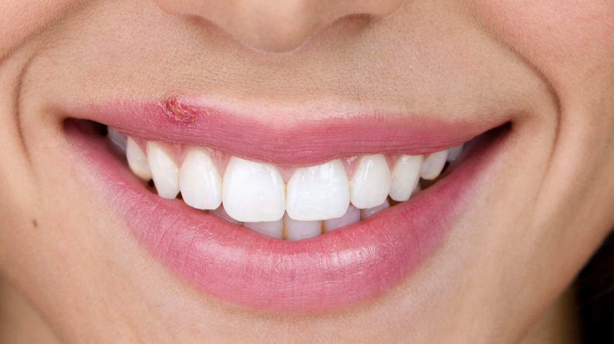istock_000035217468_medium_0