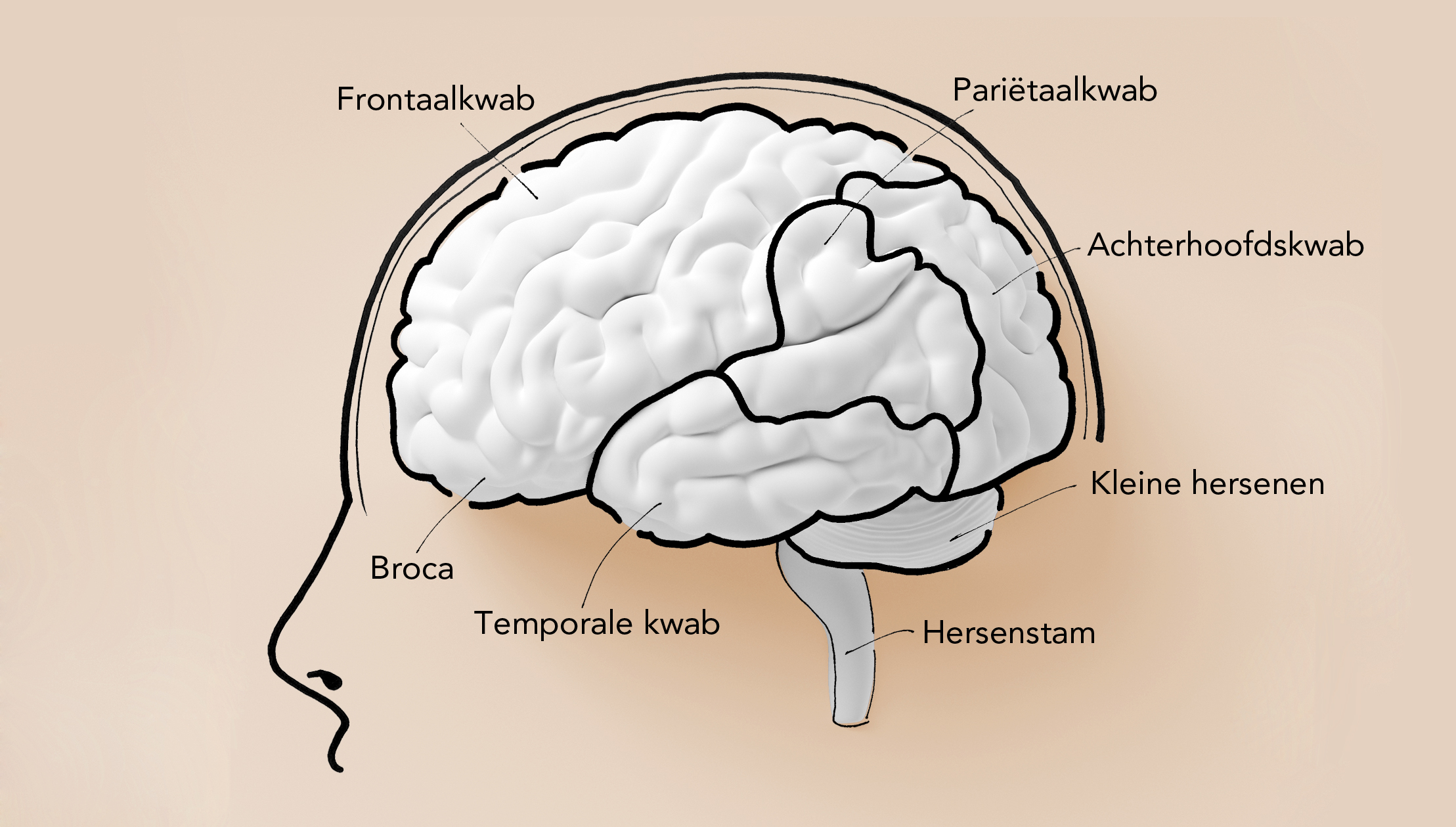 Brain On The Wall