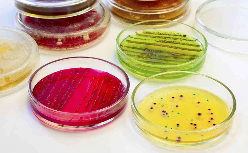 Bacterie