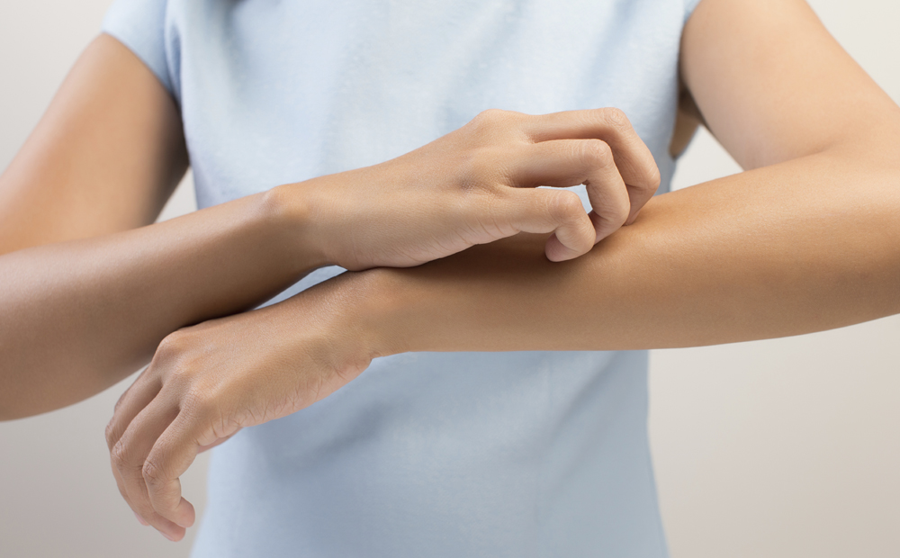 Itching In A Woman