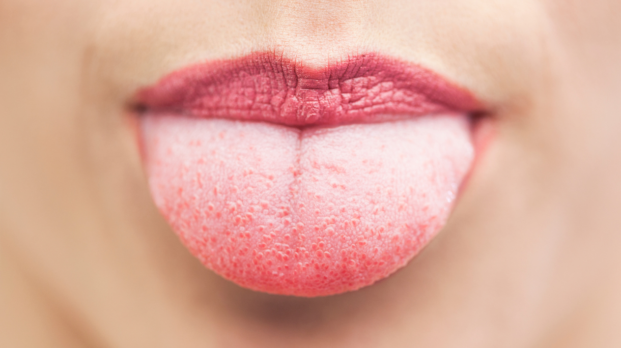 istock_44075064_large_0