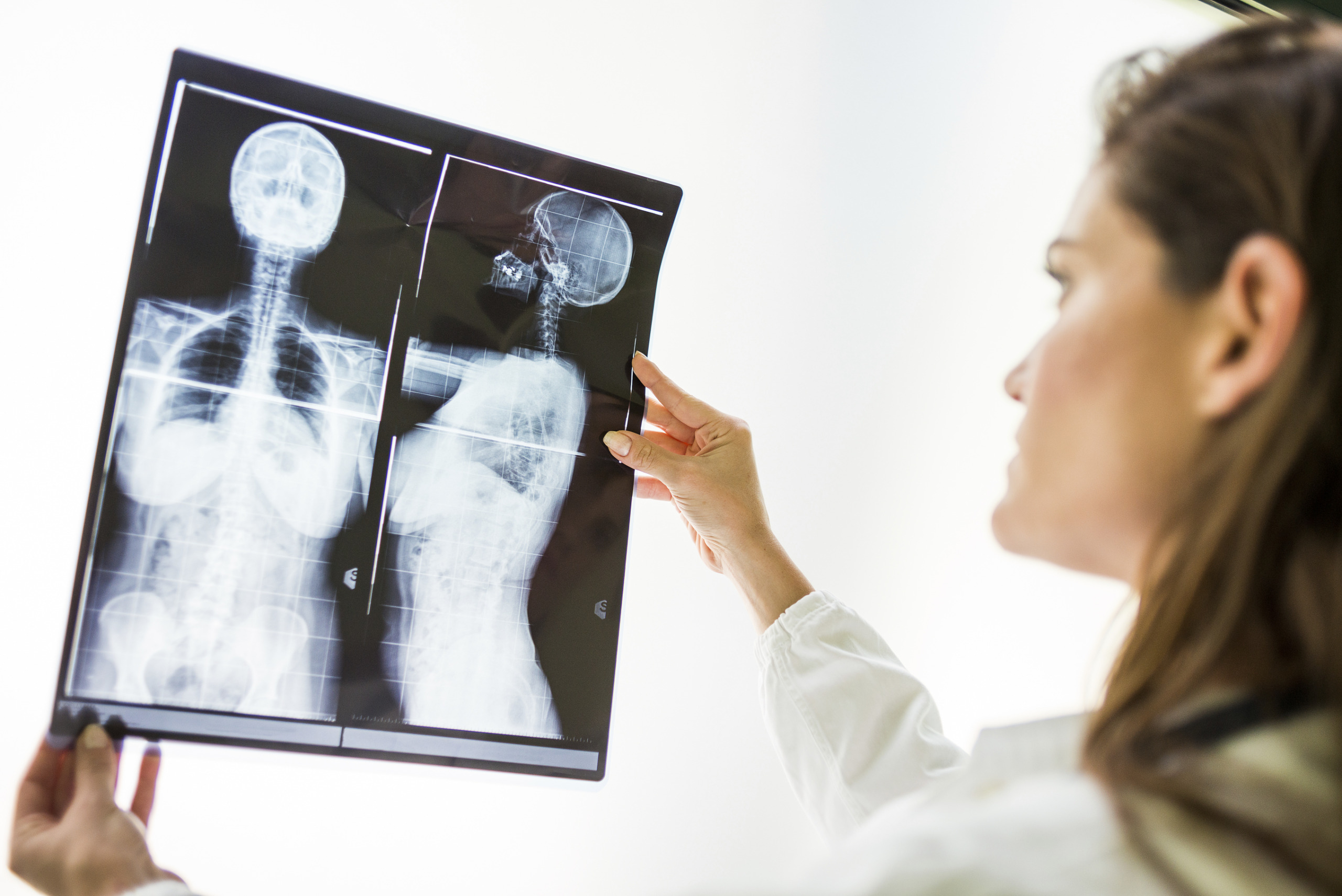 Doctor examining x-ray