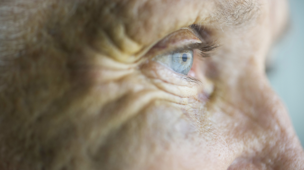 Abused caucasian senior woman with black eye