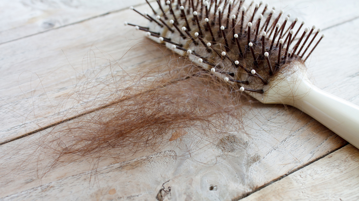 hair loss