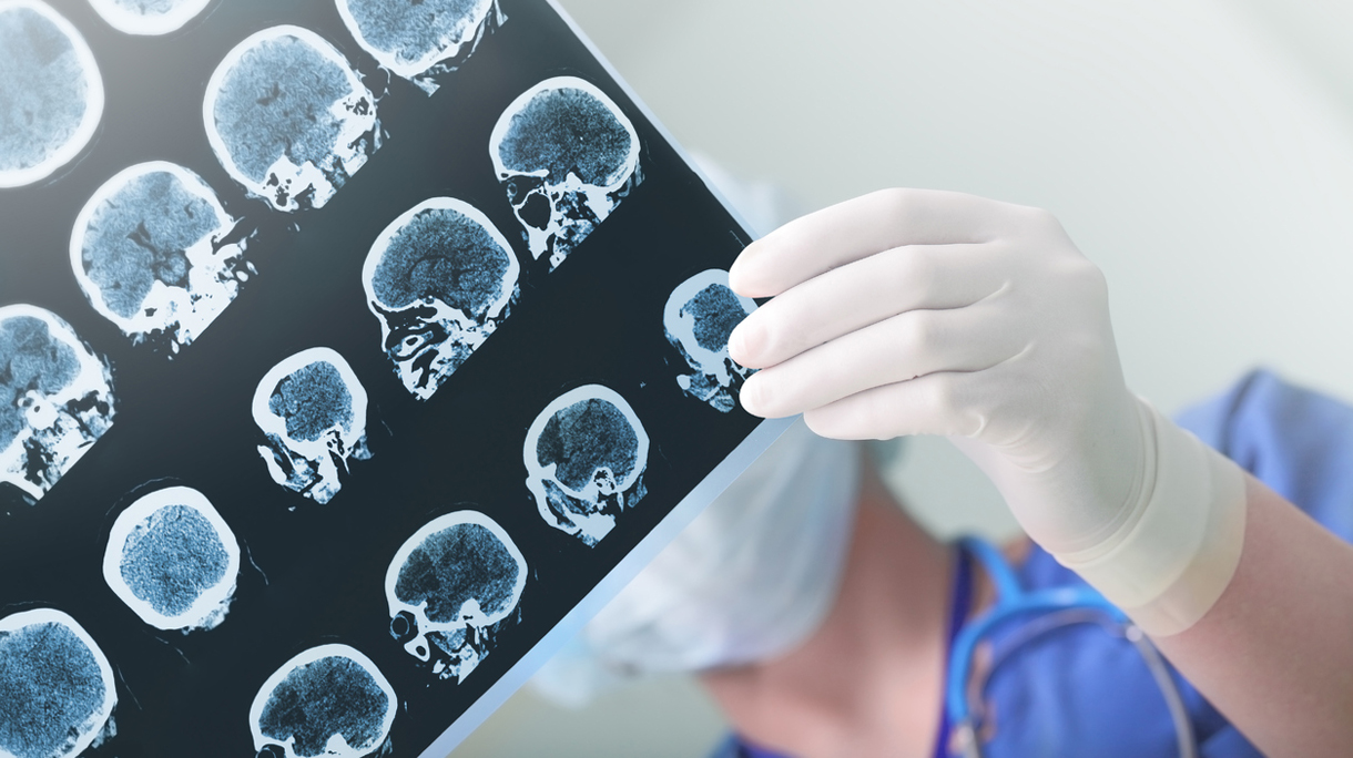 Medical experts studies the EEG condition of the patient