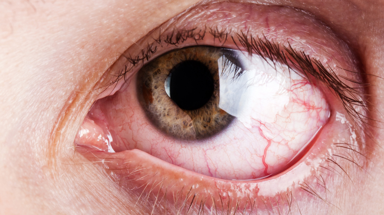 Blood capillary human eye