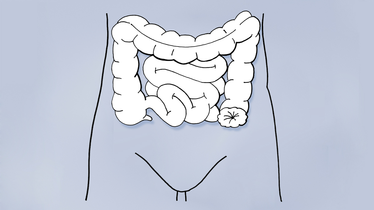 colostomalr