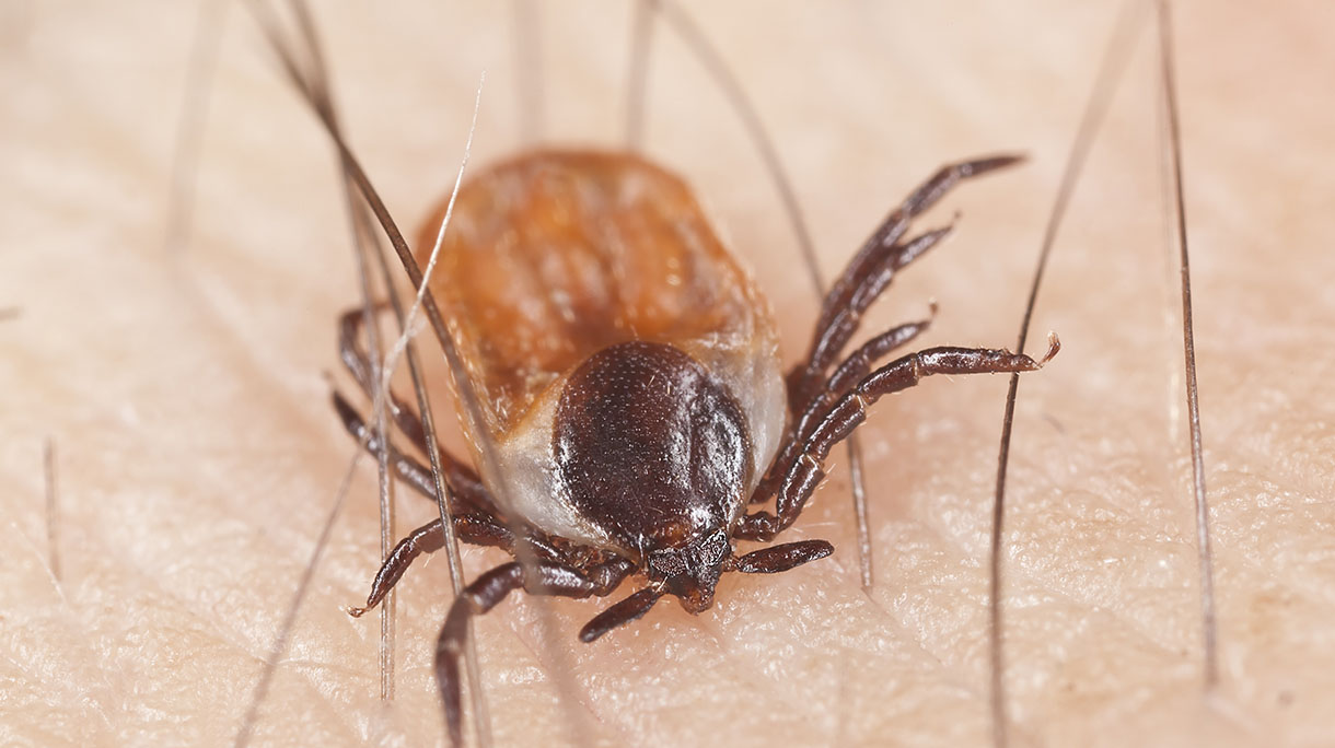 Tick feeding on human, extreme close up