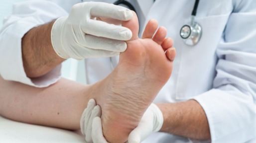 tinia-pedis-or-athletes-foot-picture-id508912041