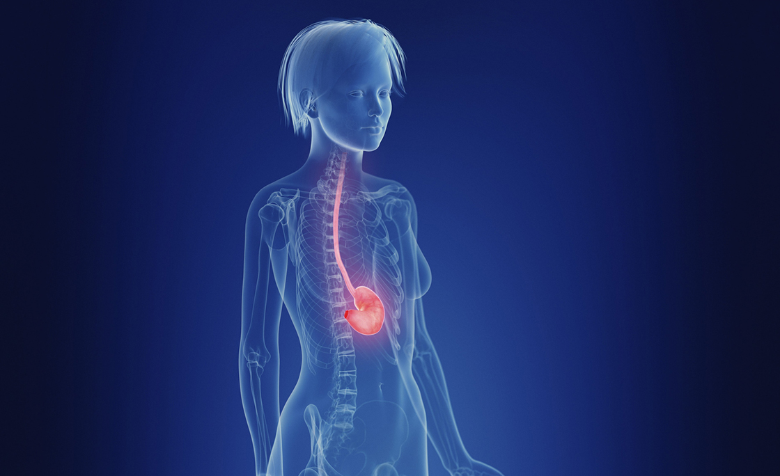 Illustration of a woman’s painful stomach