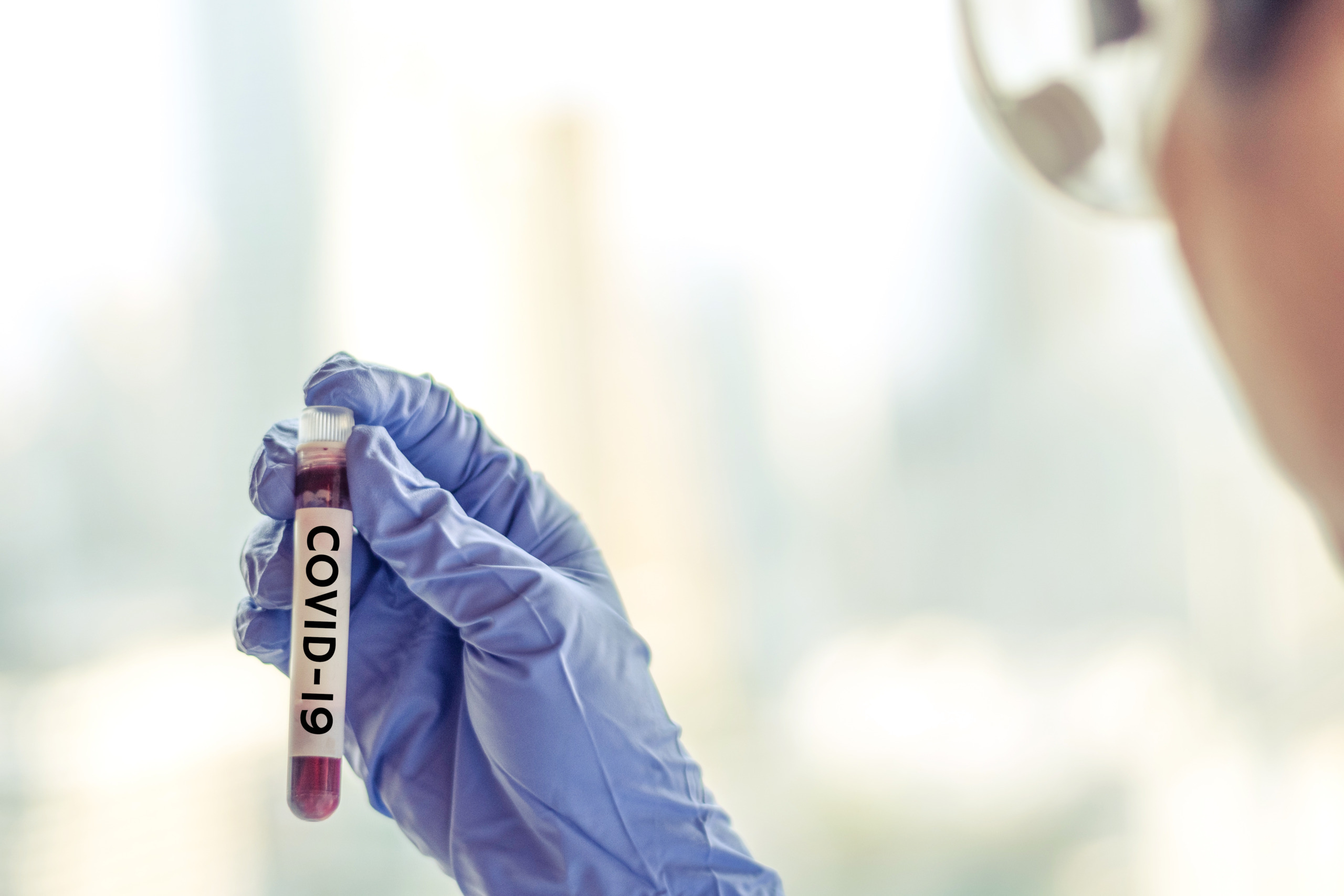 COVID-19 Novel coronavirus NCP concept. Professional doctor or lab technician holding blood sample with novel (new) coronavirus N.C.P. first identified in Wuhan, Hubei Province, China, medical and healthcare
