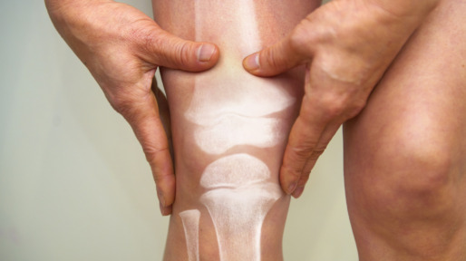 X-ray of knee – osteoarthritis and rheumatoid arthritis