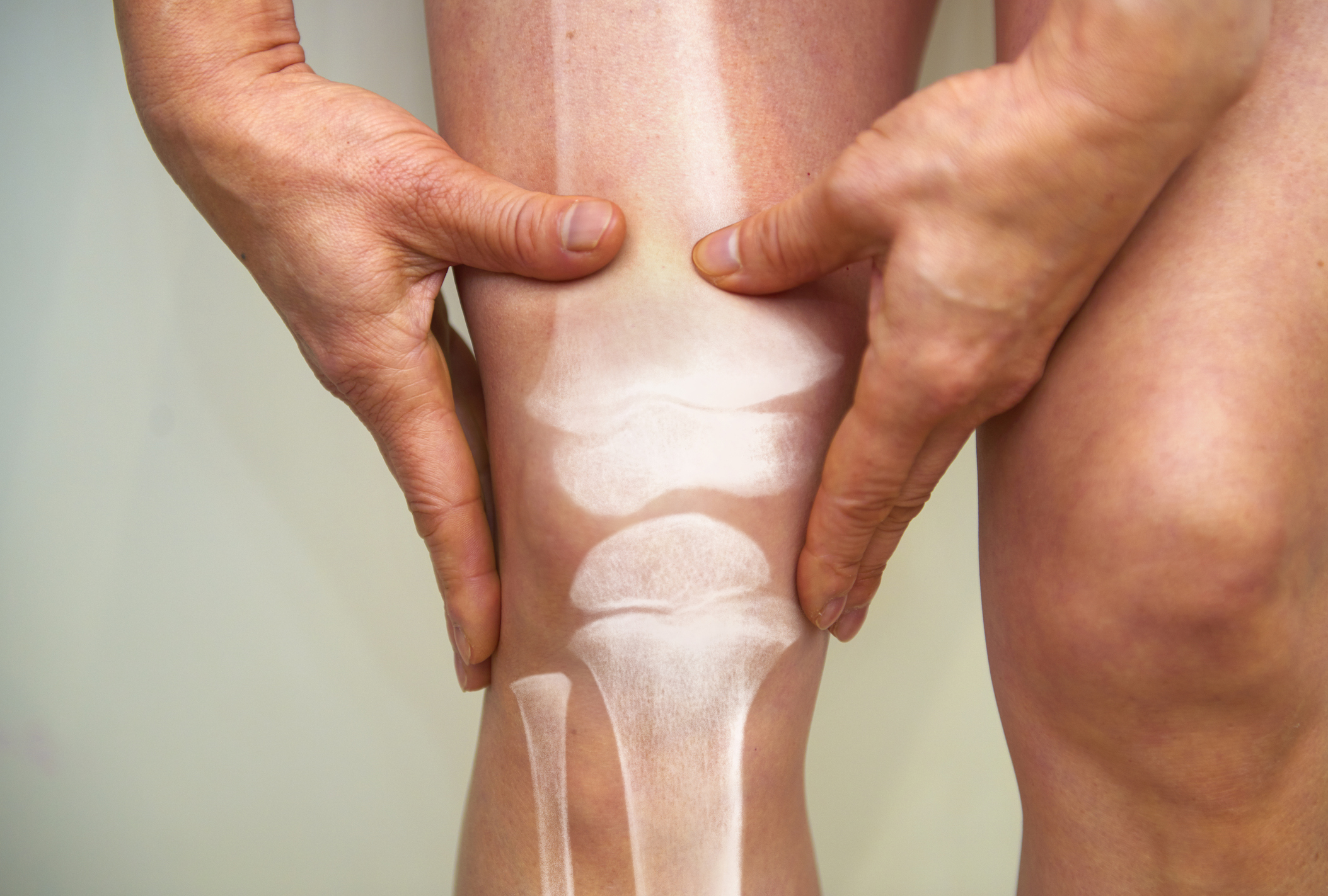 X-ray of knee – osteoarthritis and rheumatoid arthritis