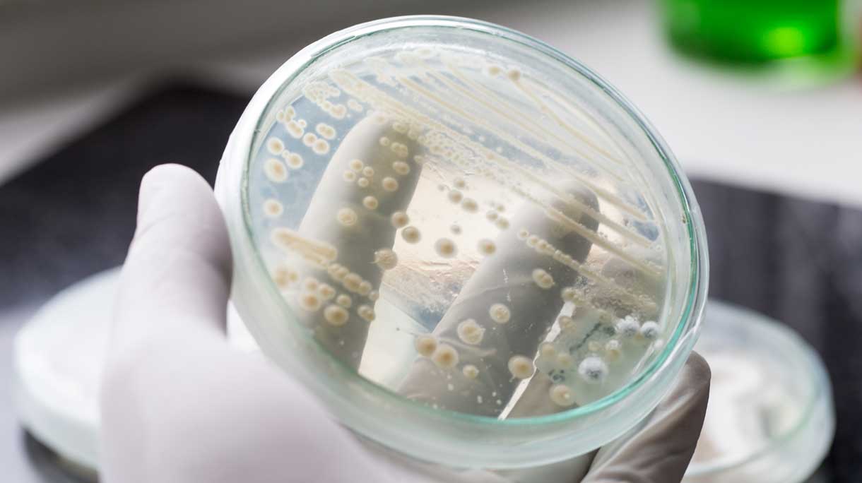 Schimmelinfectie