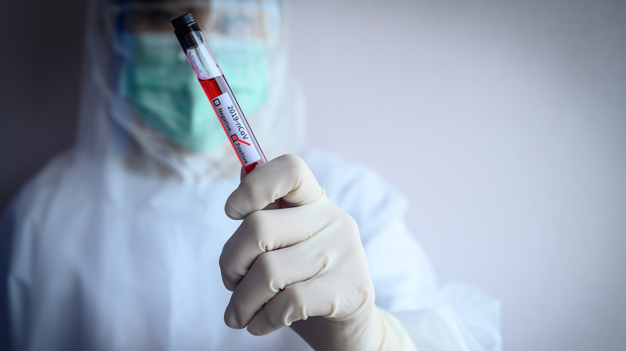 Scientist doctor holding a sample test tube with blood for 2019-nCoV analyzing.