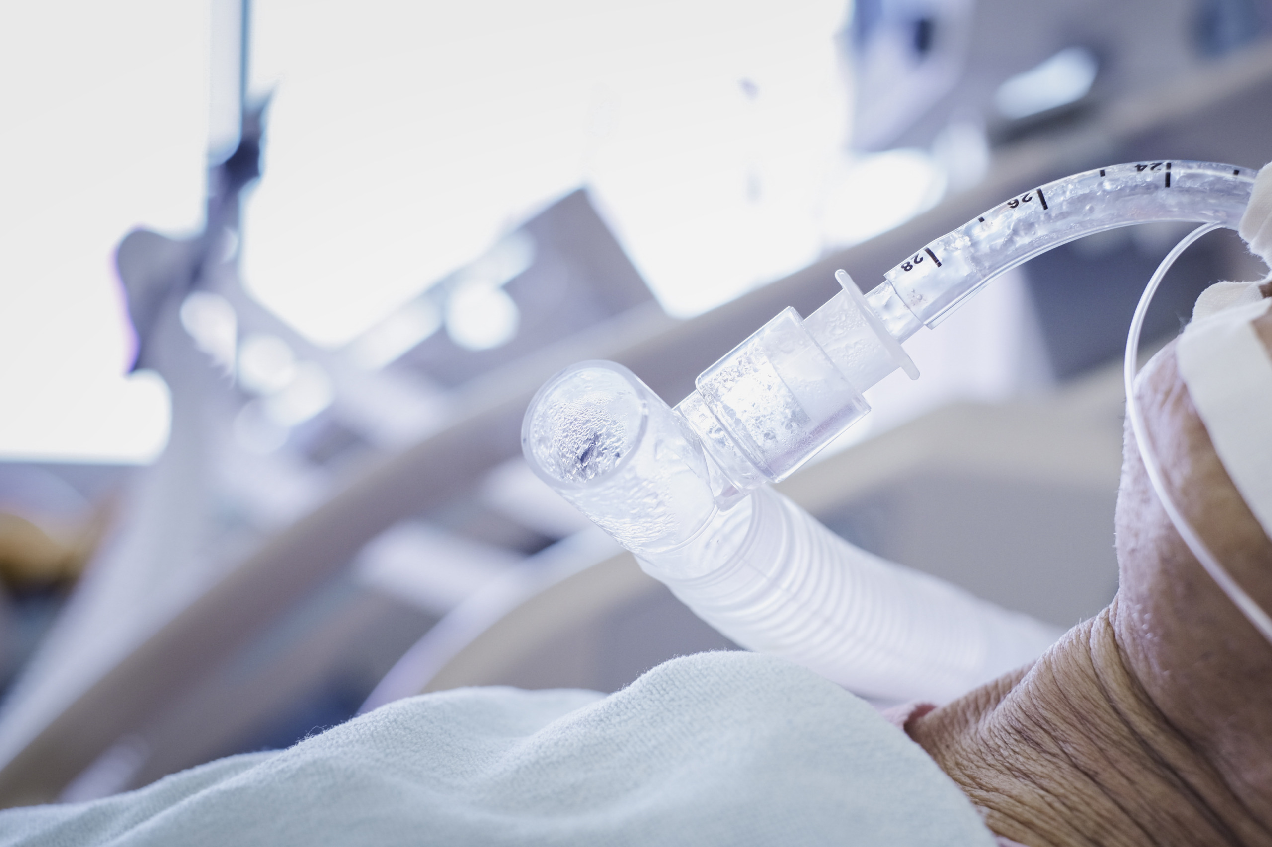 Weaning off Endotrachel tube giving oxygen to human