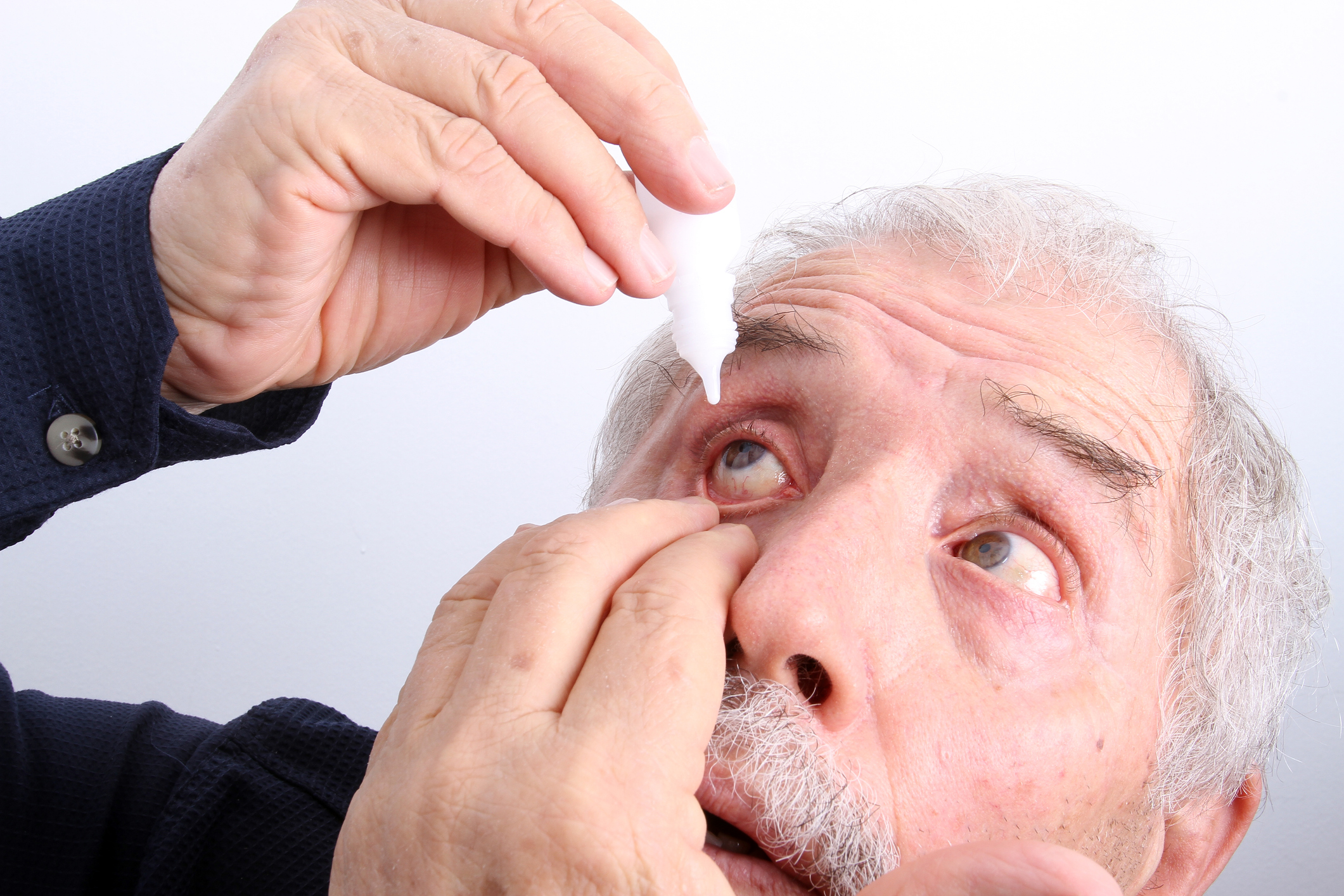 An old man implementing eyedrops to his eye