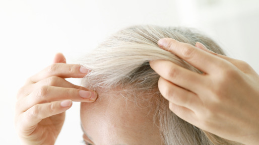 Wat kan ik doen aan dunner haar?