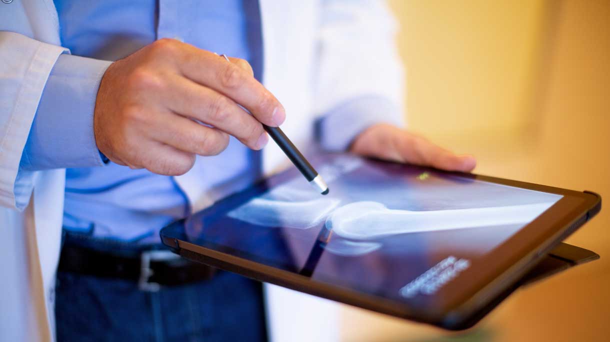 Dokter kijkt naar ipad met artrose foto
