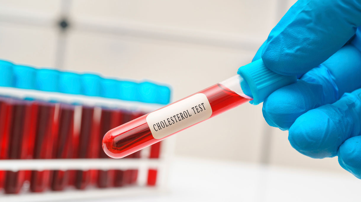cholesteroltest