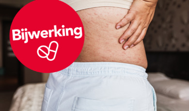 psoriasis