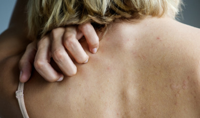 vrouw krabt op rug