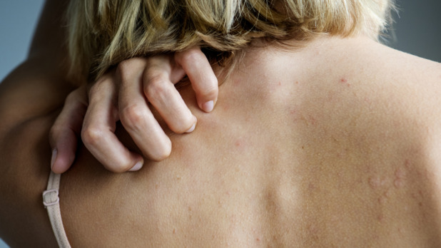 vrouw krabt op rug