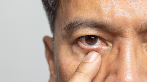 man heeft last van zijn oog