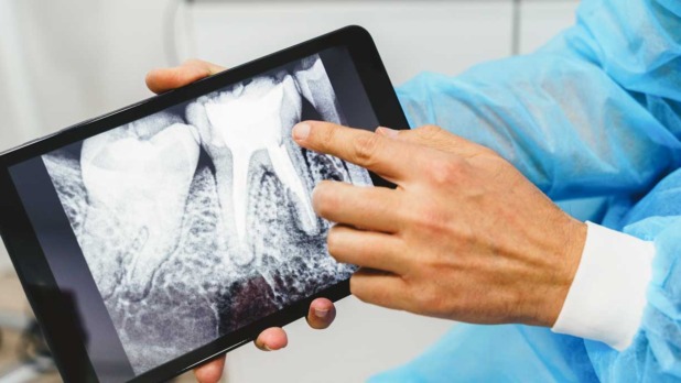 dentist met rontgenfoto