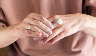 oudere vrouw smeert hormooncreme op handen