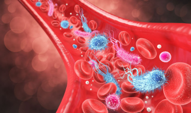 Sepsis