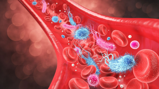 Sepsis