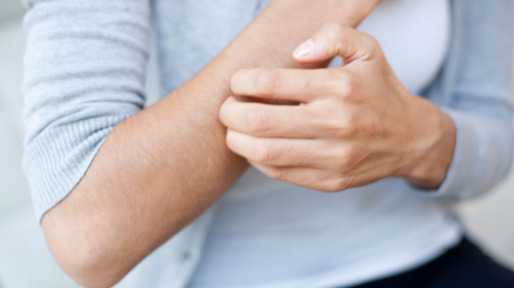 Vrouw krabt aan haar arm
