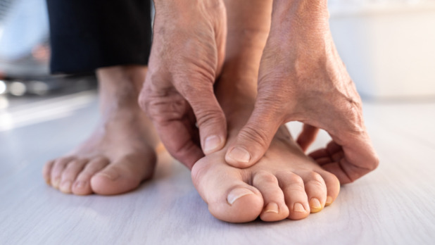 voet met hallux valgus